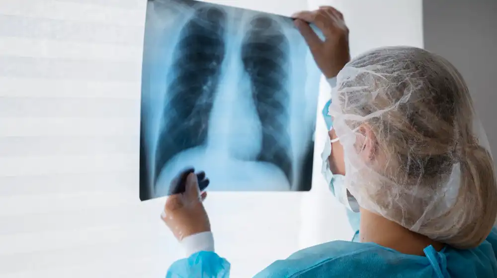 Gruźlica – objawy, diagnostyka i profilaktyka
