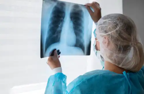 Gruźlica – objawy, diagnostyka i profilaktyka